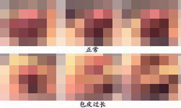 河池男性包皮过长对女性有影响吗