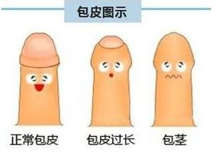 河池那个医院割包皮比较好? 河池那个医院割包皮比较好?