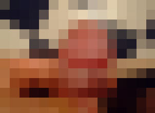 河池包皮红肿？