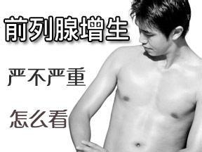 前列腺增生的检查费用高吗?